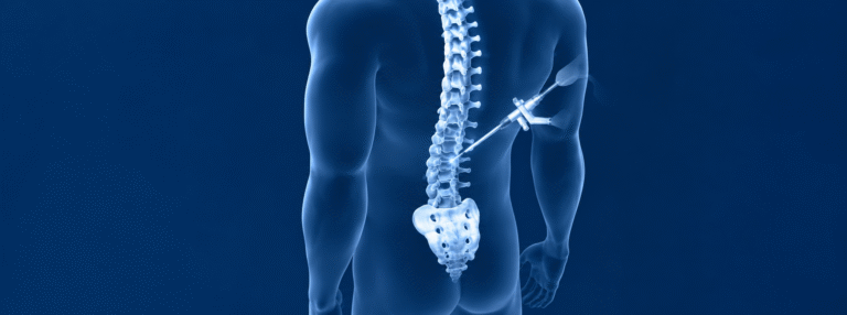 Dr. Rajesh Mishra || Endoscopic spine surgery procedure || treatment